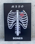 MAYO BONES POSTER